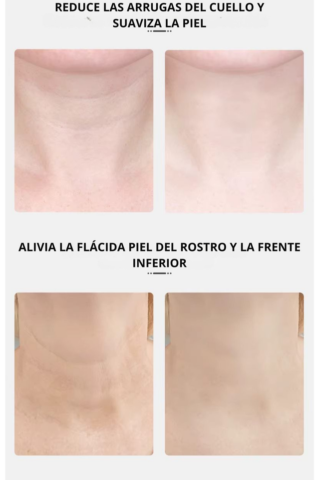 Masajeador Facial Reductor de Papada - Envió Gratis